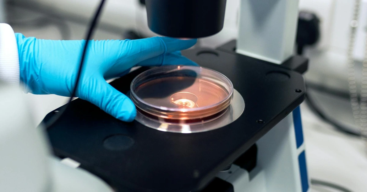 Bioengineered Intestinal Models Reveal Spondyloarthritis Disease ...